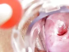 Kotor perawat mendapat solo